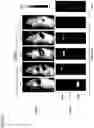 Fig. 12 - RNA formulation for immunotherapy