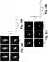 Fig. 17 - Caspase-3-triggered molecular self-assembling PET probes and uses thereof