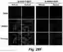 Fig. 29 - Caspase-3-triggered molecular self-assembling PET probes and uses thereof