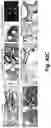 Fig. 43 - Caspase-3-triggered molecular self-assembling PET probes and uses thereof