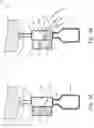Fig. 07 - MULTIPLE CHAMBER DECONTAMINATION DEVICE WITH A STERILIZING SUBSTANCE