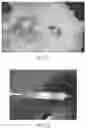 Fig. 02 - System for sutureless closure of scleral perforations and other ocular tissue discontinuities