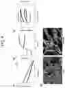Fig. 05 - METHOD FOR DECELLULARIZATION OF SKIN TISSUE, METHOD FOR CONSTRUCTION OF ARTIFICIAL SKIN, METHOD FOR PREPARATION OF HYDROGEL OF DECELLULARIZED SKIN TISSUE, LYOPHILIZED, DECELLULARIZED SKIN TISSUE, AND BIOINK