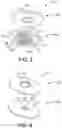 Fig. 04 - Negative pressure wound therapy system