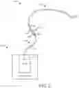 Fig. 03 - Fluid ingress protection for NPWT device
