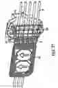 Fig. 47 - Medical treatment system and methods using a plurality of fluid lines
