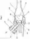 Fig. 03 - NEBULIZER UNIT WITH EXCHANGABLE MOUTHPIECE