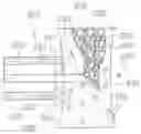 Fig. 01 - Methods, medical devices and kits for modifying the luminal profile of a body vessel