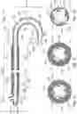 Fig. 05 - Orientable catheter, device and method of surgical intervention