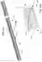 Fig. 51 - SYSTEMS, METHODS AND APPARATUS FOR GUIDING AND SUPPORTING CATHETERS SUCH AS STENT DELIVERY CATHETERS