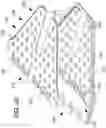 Fig. 56 - SYSTEMS, METHODS AND APPARATUS FOR GUIDING AND SUPPORTING CATHETERS SUCH AS STENT DELIVERY CATHETERS