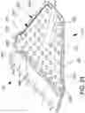 Fig. 57 - SYSTEMS, METHODS AND APPARATUS FOR GUIDING AND SUPPORTING CATHETERS SUCH AS STENT DELIVERY CATHETERS