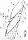 Fig. 60 - SYSTEMS, METHODS AND APPARATUS FOR GUIDING AND SUPPORTING CATHETERS SUCH AS STENT DELIVERY CATHETERS