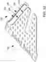 Fig. 61 - SYSTEMS, METHODS AND APPARATUS FOR GUIDING AND SUPPORTING CATHETERS SUCH AS STENT DELIVERY CATHETERS