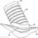Fig. 01 - Delivery system for implantable flow connector