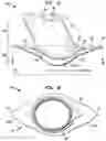 Fig. 02 - Delivery system for implantable flow connector