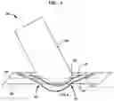 Fig. 08 - Delivery system for implantable flow connector