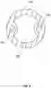 Fig. 03 - URETHRAL BALLOON DILATOR CATHETER