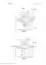 Fig. 17 - Method for administering a medicament suitable for treating a migraine or cluster headache