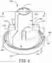 Fig. 06 - HEMOSTASIS SEALING DEVICE WITH CONSTRICTION RING