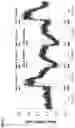 Fig. 09 - Neuromodulation device