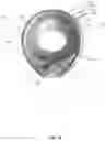 Fig. 03 - Electrical inhibition (EI) uterine pacemaker for controlling uterine contractions