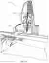 Fig. 02 - Device implantation using a cartridge