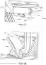 Fig. 08 - Device implantation using a cartridge
