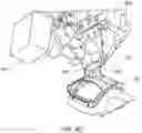 Fig. 14 - Device implantation using a cartridge