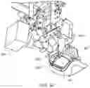 Fig. 20 - Device implantation using a cartridge