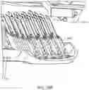 Fig. 23 - Device implantation using a cartridge