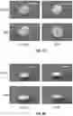 Fig. 10 - METHOD AND APPARATUS TO PERFORM STRUCTURAL AND MECHANICAL CHANGE TO JOINT CAPSULE, TENDON, AND LIGAMENT