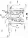 Fig. 16 - Power element for an implantable medical device