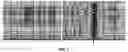 Fig. 02 - Systems and methods for cooperative invasive and noninvasive brain stimulation