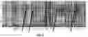 Fig. 03 - Systems and methods for cooperative invasive and noninvasive brain stimulation
