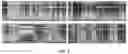 Fig. 04 - Systems and methods for cooperative invasive and noninvasive brain stimulation