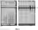 Fig. 06 - Systems and methods for cooperative invasive and noninvasive brain stimulation