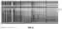 Fig. 07 - Systems and methods for cooperative invasive and noninvasive brain stimulation