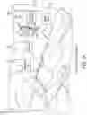 Fig. 04 - MRI-compatible cardiac defibrillator