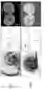 Fig. 17 - Multi-imager compatible robot for image-guided interventions and fully automated brachytherapy seed