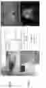 Fig. 18 - Multi-imager compatible robot for image-guided interventions and fully automated brachytherapy seed