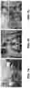 Fig. 02 - Systems and methods for opening of a tissue barrier in primates