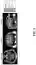 Fig. 05 - Systems and methods for opening of a tissue barrier in primates