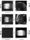 Fig. 07 - Systems and methods for opening of a tissue barrier in primates