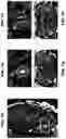 Fig. 10 - Systems and methods for opening of a tissue barrier in primates