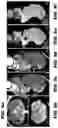 Fig. 12 - Systems and methods for opening of a tissue barrier in primates