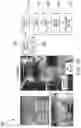 Fig. 19 - Systems and methods for opening of a tissue barrier in primates