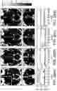Fig. 30 - Systems and methods for opening of a tissue barrier in primates