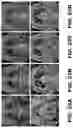 Fig. 31 - Systems and methods for opening of a tissue barrier in primates