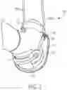 Fig. 04 - Wearable anchor for a therapy device
